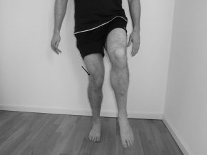 Hüftgelenks Adduktion und Kniegelenks Innenrotation in der Standbeinphase bei einem Läuferknie